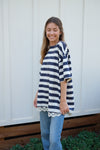 The Striped Everyday Lace Tshirt Dress in Navy